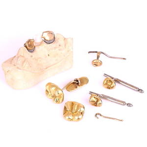 TANDGULD, manschettknappar och kragknappar samt i protes, Nettovikt ca 6 gram.